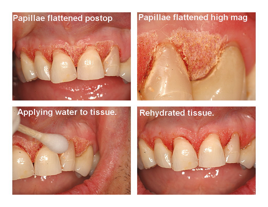 Veneers and recontouring pg5.jpg